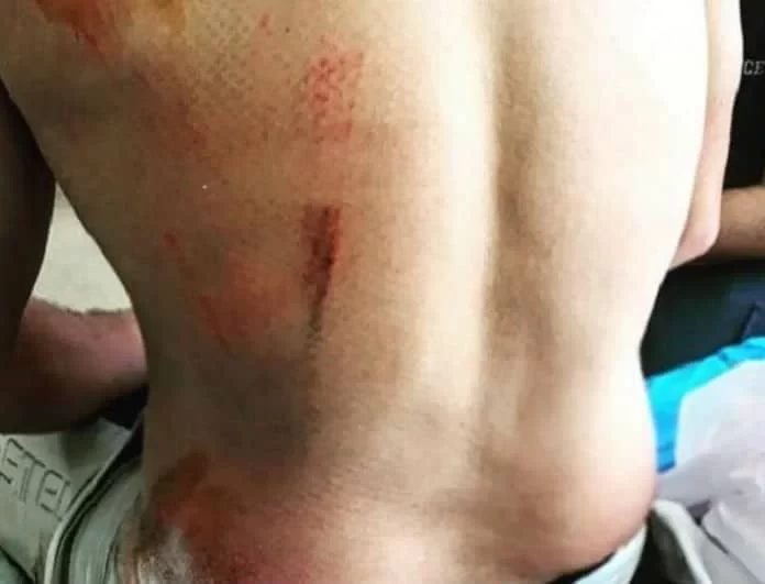 Σοκ στο Αγρίνιο: Σκύλος επιτέθηκε σε αστυνομικό που έκανε ποδήλατο! Σκληρές εικόνες!