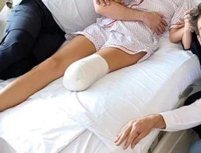 Τραγικές στιγμές για μοντέλο - Μπήκε χειρουργείο για να αφαιρέσει έναν όγκο και της έκοψαν το πόδι