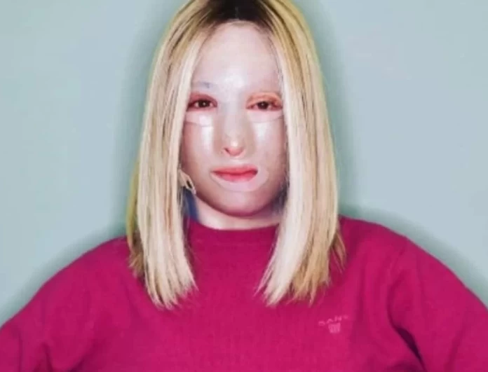 Η δεύτερη φωτογραφία της Ιωάννας Παλιοσπύρου χωρίς μάσκα - Τα σημάδια από το βιτριόλι