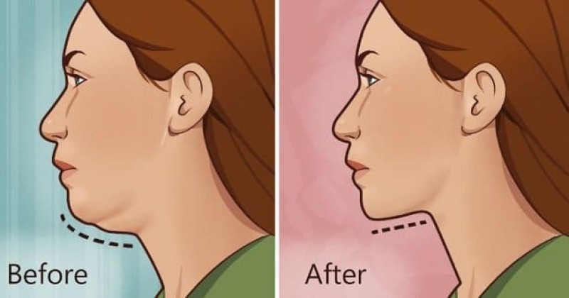 πώς να χάσετε γρήγορα βάρος στο πρόσωπο και τα μάγουλα)