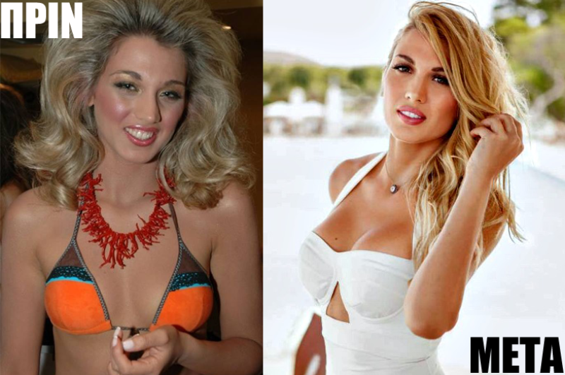 Φωτογραφίες της Κωνσταντίνας Σπυροπούλου πριν και μετά τις πλαστικές σε στήθος και πρόσωπο!