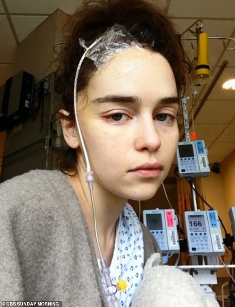 Η ηθοποιός Εμίλια Κλαρκ στο νοσοκομείο μετά από εγκεφαλικό