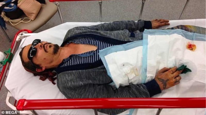 Εικόνα σοκ! Πασίγνωστος ηθοποιός στο νοσοκομείο μετά από καβγά με την σύντροφό του!