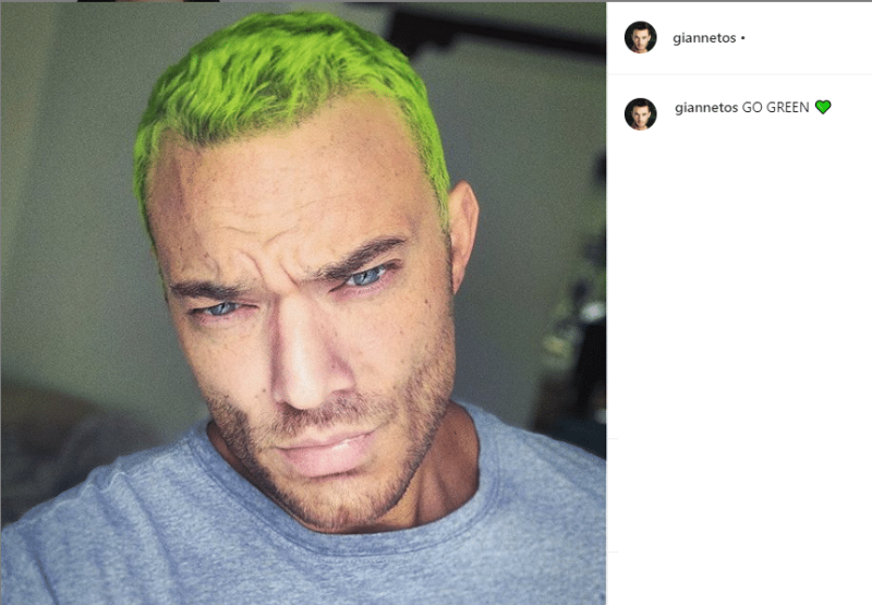 Δημήτρης Γιαννέτος: Απίστευτο! Έβαψε πράσινα τα μαλλιά του!