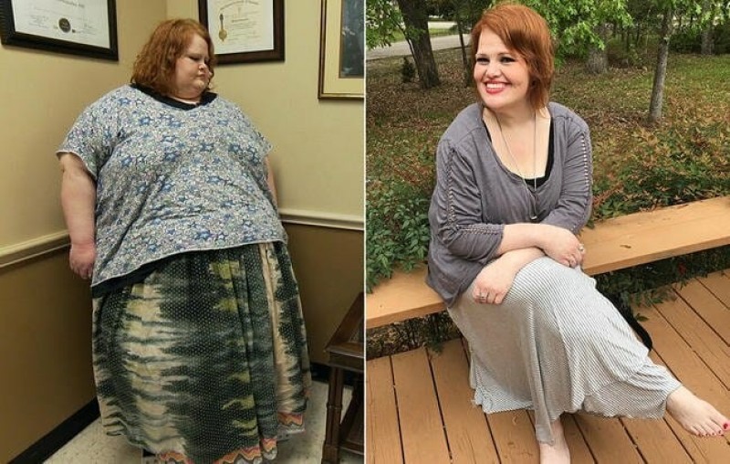 Την έλεγαν χοντρή όλη της την ζωή - Έχασε 206 κιλά και έγινε αγνώριστη!
