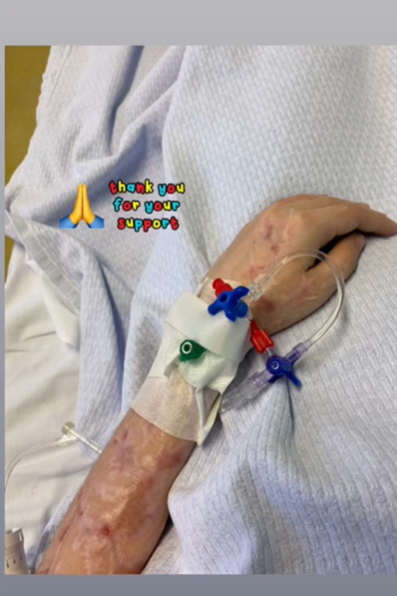 Επίθεση με βιτριόλι ανατριχιάζει η φωτογραφία της Ιωάννας μέσα από το νοσοκομείο