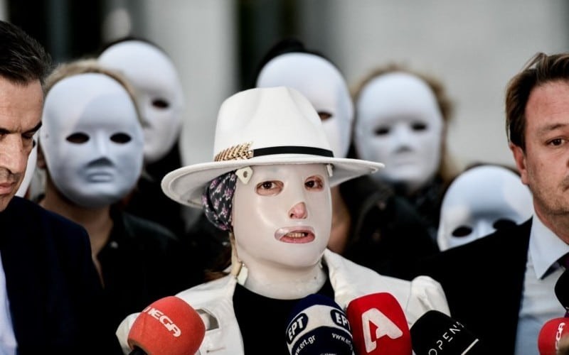 Επίθεση με βιτριόλισ υγκίνησαν οι φίλες της Ιωάννας - Φόρεσαν λευκές μάσκες στο δικαστήριο