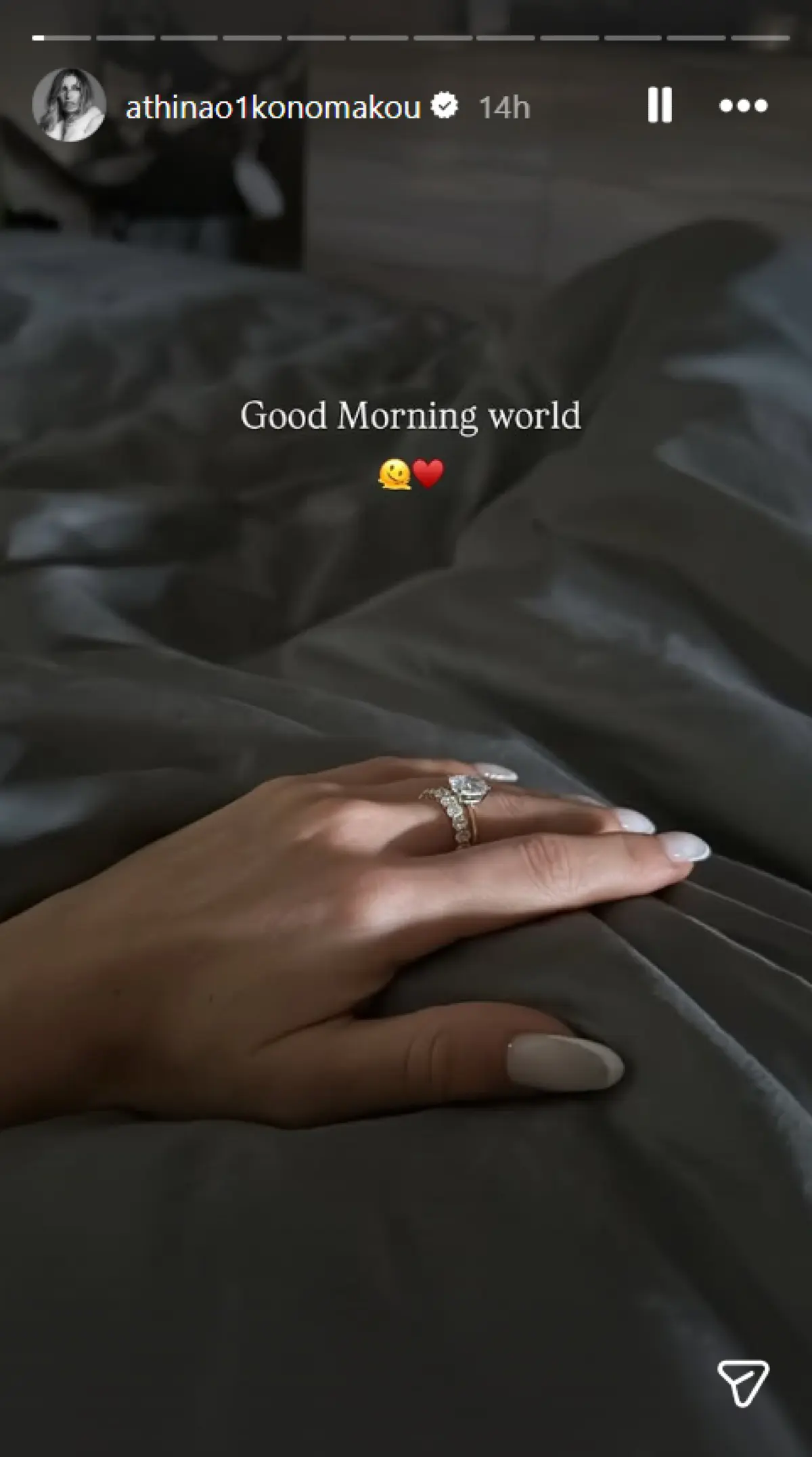 Αθηνά Οικονομάκου: Ρωτήσαμε το ChatGPT πόσο κοστίζει το δαχτυλίδι της πρότασης γάμου