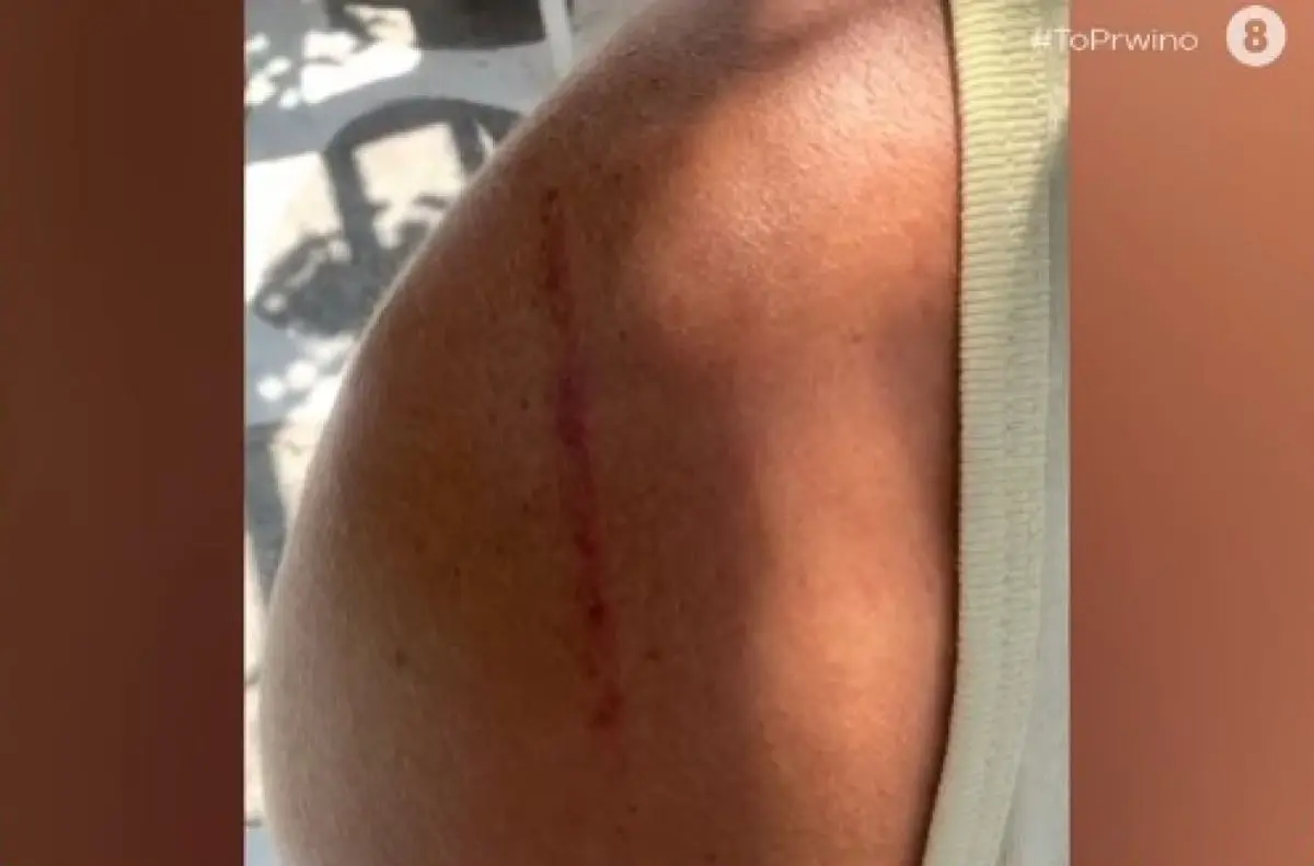 Δόξας: «Βρείτε το θάρρος να παραδεχτείτε πως είστε θύματα» - H όλο νόημα ανάρτηση μετά τη συνέντευξη - «κόλαφο» στον Λιάγκα