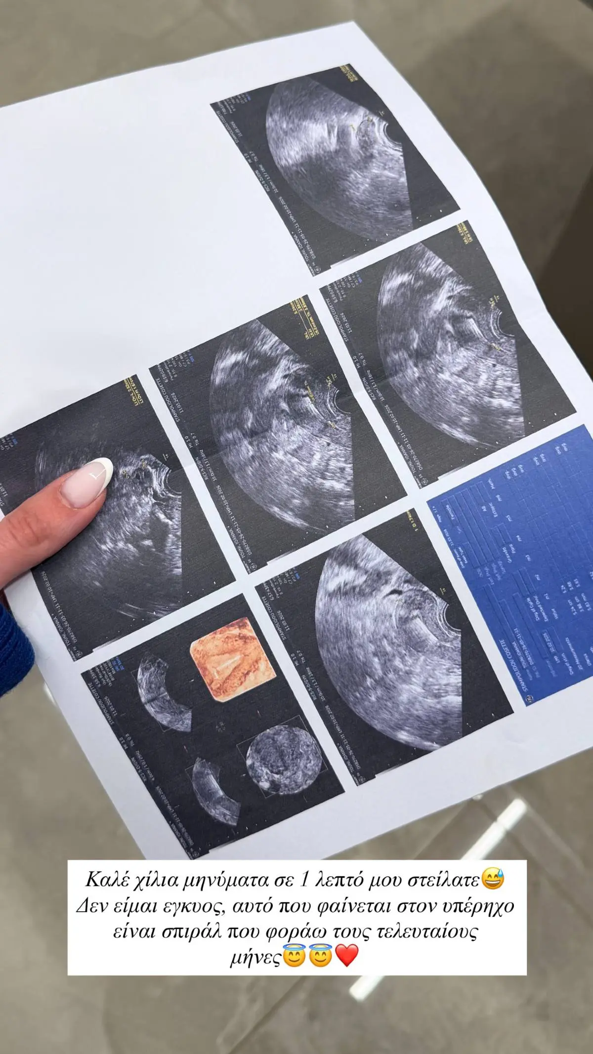 Η Ιωάννα Τούνη στον γυναικολόγο