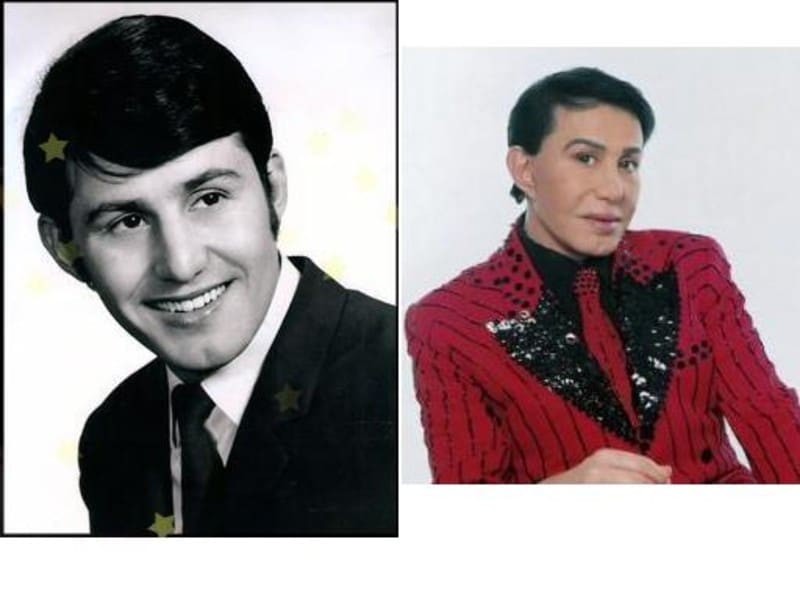 Έτσι ήταν το πρόσωπο του Γιάννη Φλωρινιώτη πριν από τις 5 πλαστικές επεμβάσεις