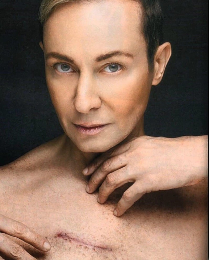 Βασίλειος Κωστέτσος επέμβαση ανοιχτής καρδιάς