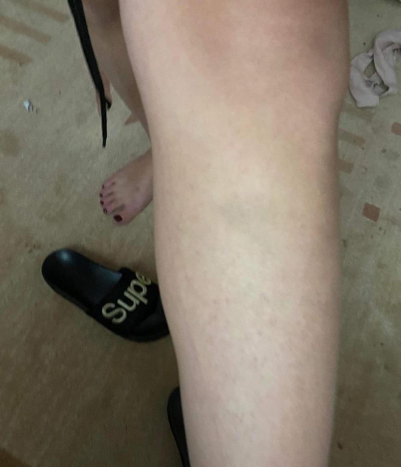 Βιασμός 24χρονης Θεσσαλονίκη φωτογραφίες