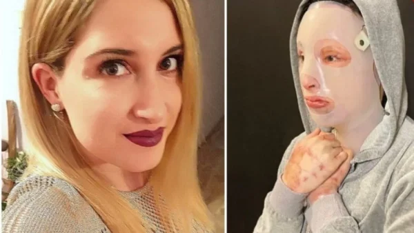 Ιωάννα Παλιοσπύρου: Το νέο ξεκίνημα 1,5 χρόνο μετά από την επίθεση με το βιτριόλι