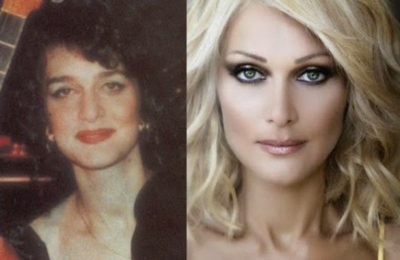 Νατάσα Θεοδωρίδου πριν πλαστικές