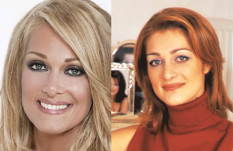 Νατάσσα Θεοδωρίδου πλαστικές