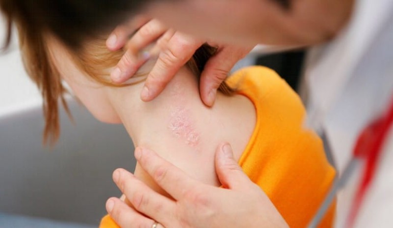 Survivor 4 Κάτια Ταραμπάνκο αυτοάνοσο