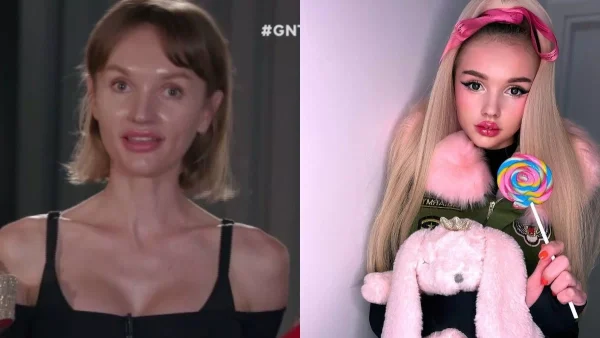 Σοκαριστικό: Σήμερα μοιάζει με 16χρονο κοριτσάκι - Η Αλιόνα από το GNTM παραμορφώθηκε από τις πλαστικές