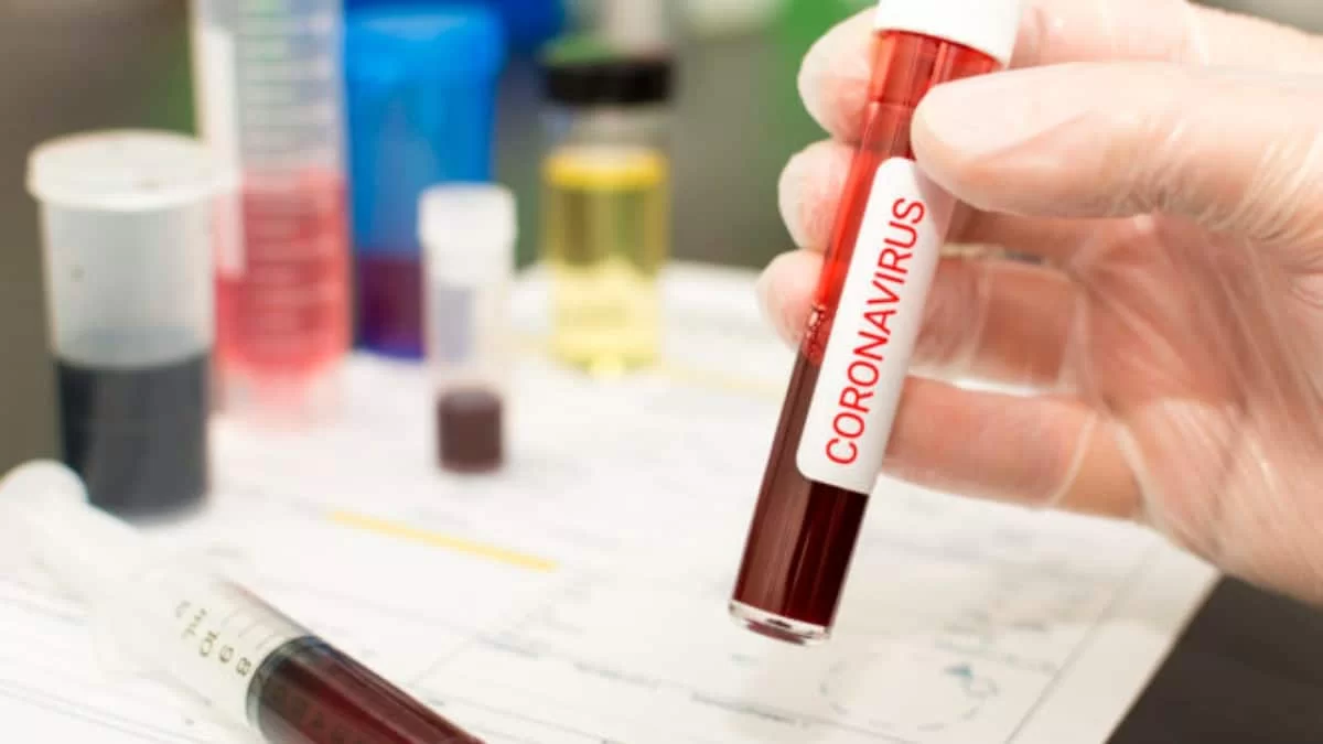 Κορωνοϊός: Αυτά είναι τα νέα κρούσματα στην Ελλάδα 3/3