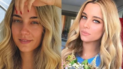 Καλύπτει σπυράκια και κοκκινίλες βάζοντας... - Το μυστικό της Δούκισσας Νομικού για αψεγάδιαστη επιδερμίδα