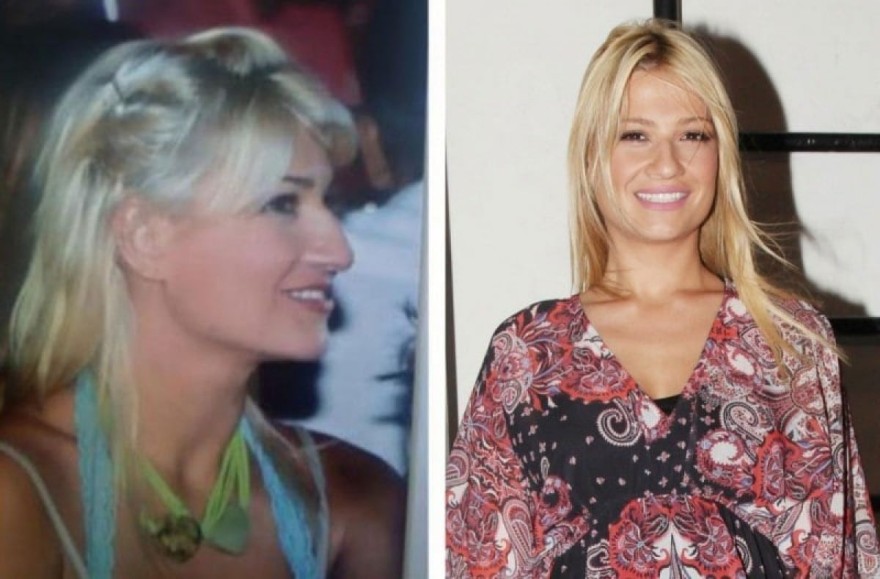 Φαίη Σκορδά - Πλαστική