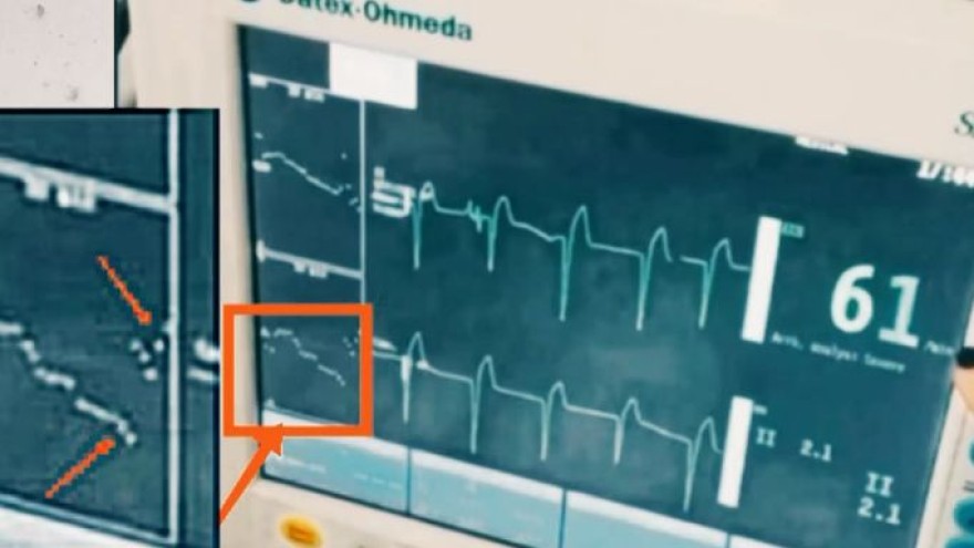 Ρούλα Πισπιρίγκου