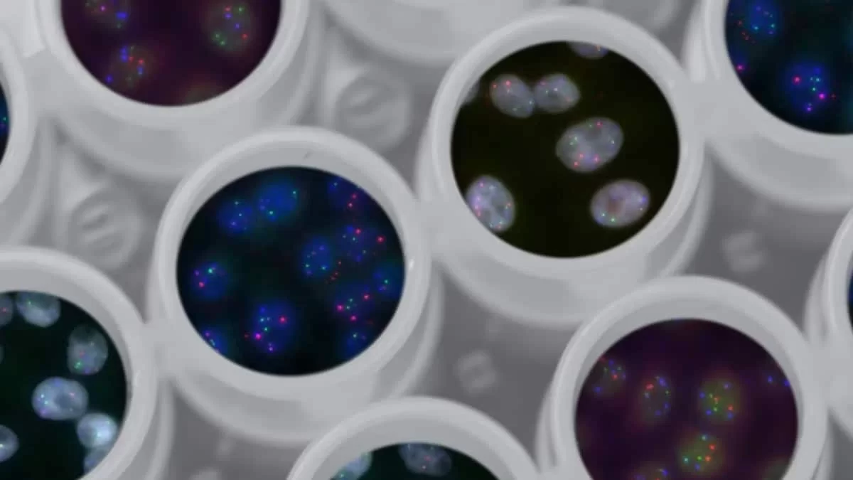 Ευλογιά των Πιθήκων: Πώς μεταδίδεται η νόσος - Τα συμπτώματα που προκαλούν ανησυχία