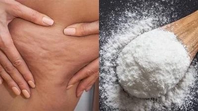Εξαφάνισε την κυτταρίτιδα ανακατεύοντας μαγειρική σόδα κι ένα ακόμη υλικό που βρίσκεται στην κουζίνα σου