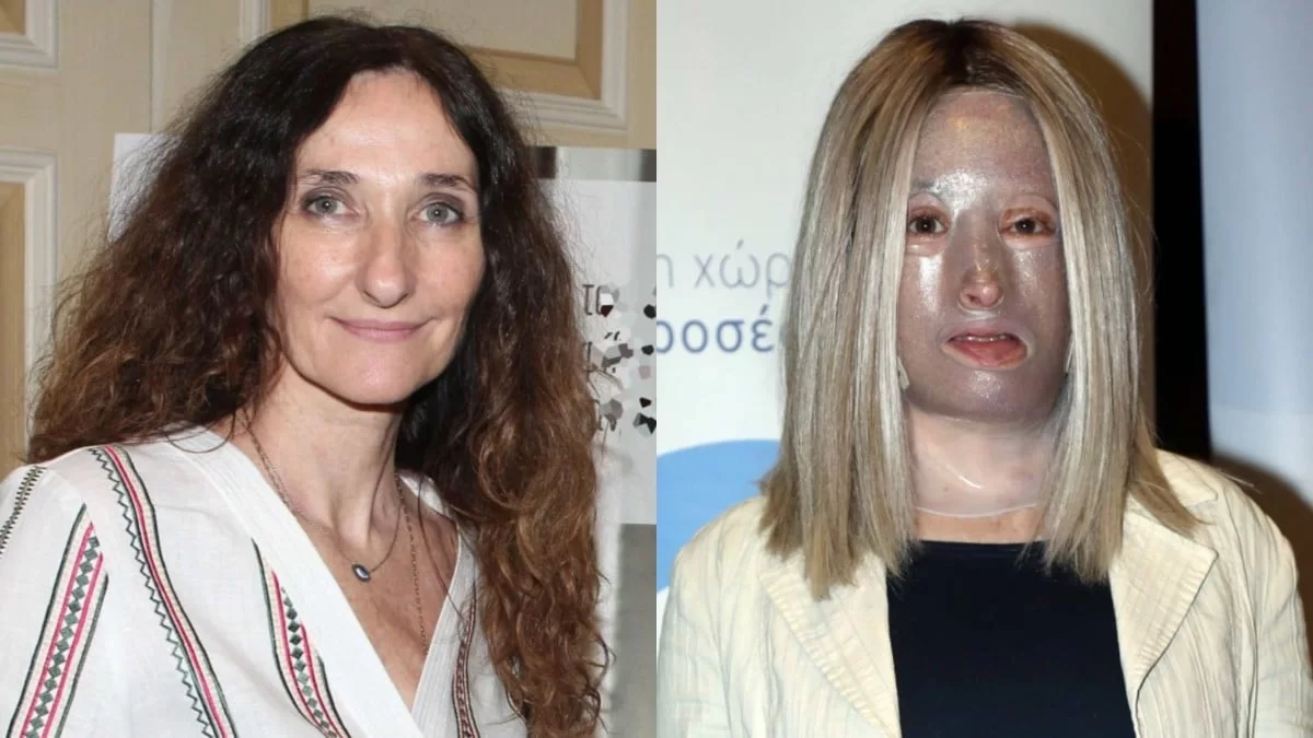 H Oλυμπία Κρασαγάκη αποκάλυψε ότι έχει καρκίνο - Το μήνυμα στήριξης της Ιωάννας Παλιοσπύρου