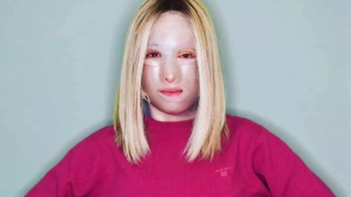 Σε κέντρο αποκατάστασης στην Γαλλία η Ιωάννα Παλιοσπύρου - Το βίντεο που δημοσίευσε χωρίς μάσκα