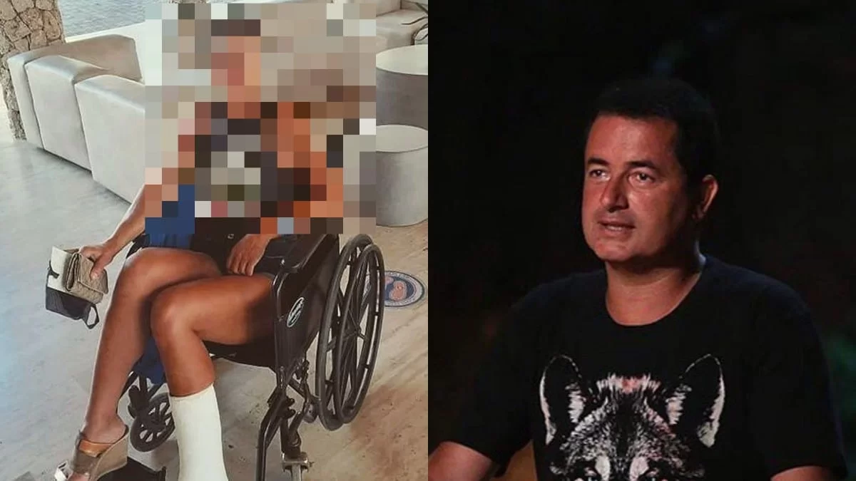 Πρώην παίκτρια του Survivor στρέφεται νομικά κατά της Acun Medya για τον σοβαρό τραυματισμό της