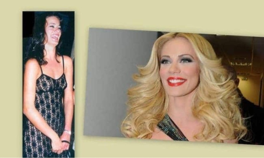 Ζέτα Μακρυπούλια μελαχρινή πλαστική στήθους