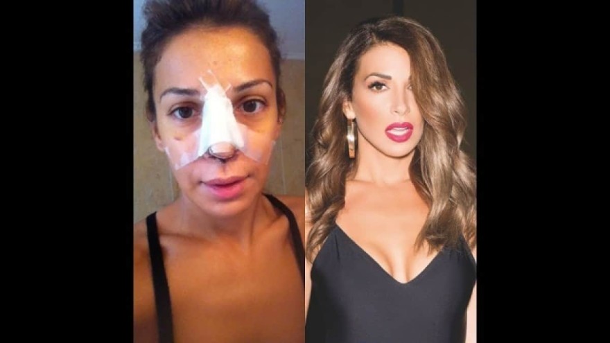 Πριν και μετά τις πλαστικές - Έτσι ήταν η Ελένη Χατζίδου