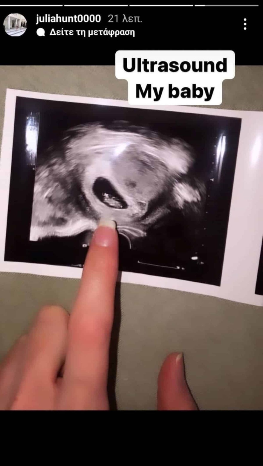 Τζούλια Αλεξανδράτου υπερηχογράφημα μωρού