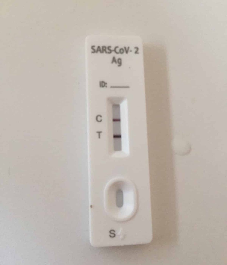 Θετικός στον κορωνοϊό ο Γιώργος Παρτσαλάκης