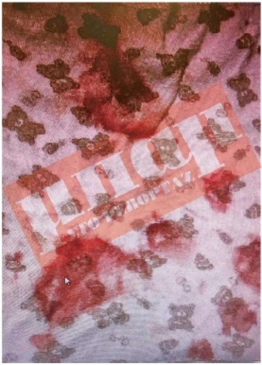 Τραγωδία Πάτρα - Εξελίξεις με την υπόθεση