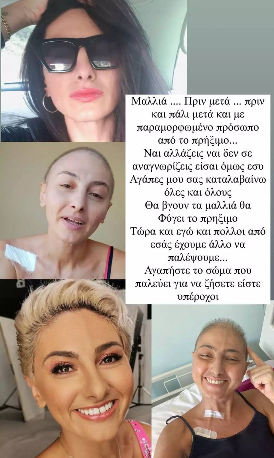 Οι αναρτήσεις της Ρεγγίνας Μακέδου με τις αλλαγές από τον καρκίνο