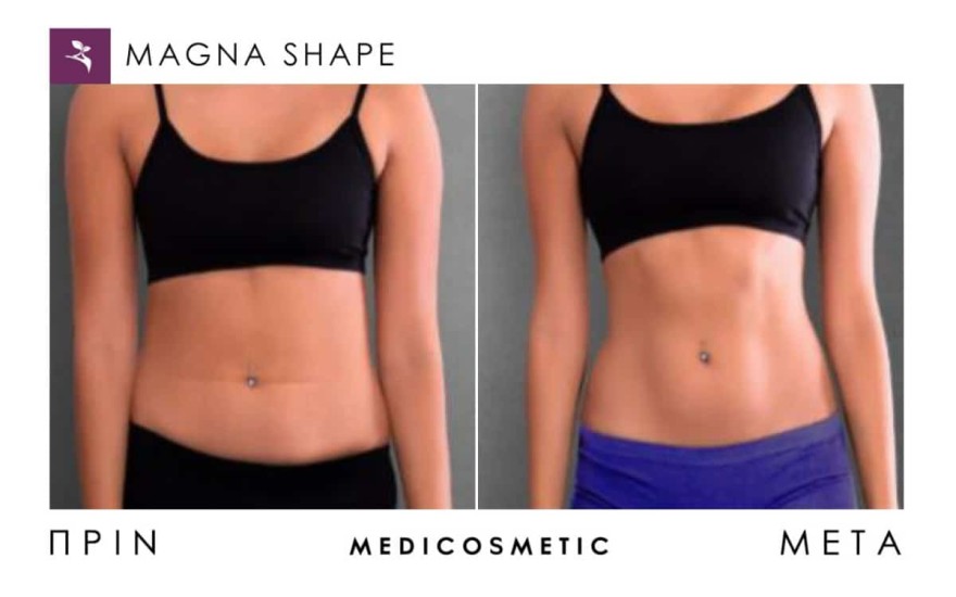 Medi Cosmetic θεραπείες