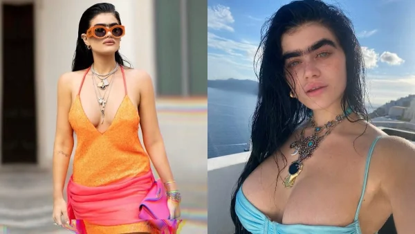 Χωρίς χείλη, ζυγωματικά και στήθος - Πως ήταν ή Σοφία Χατζηπαντελή πριν τις πλαστικές