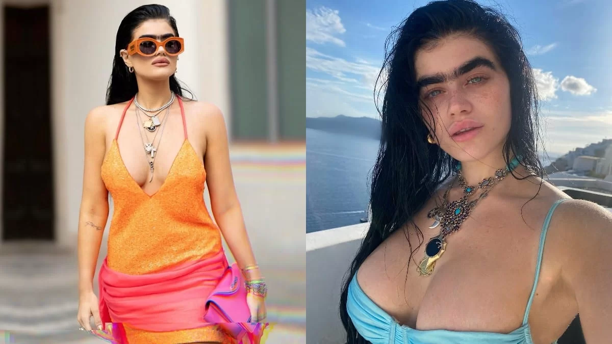 Χωρίς χείλη, ζυγωματικά και στήθος - Πως ήταν ή Σοφία Χατζηπαντελή πριν τις πλαστικές