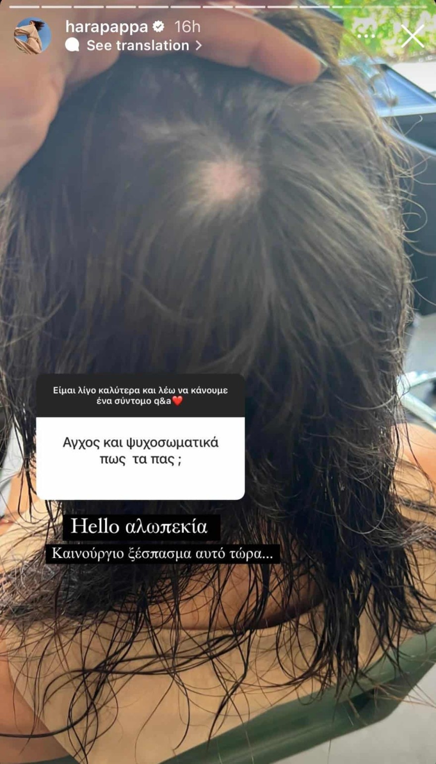 Χαρά Παππά χάνει τα μαλλιά