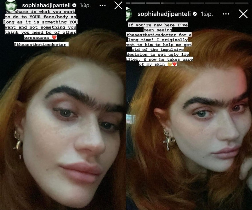 Οι αναρτήσεις της Χατζηπαντελή