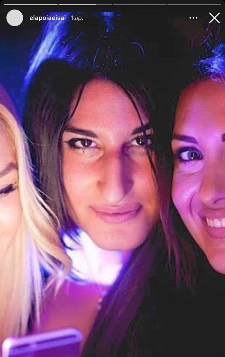 Μάιρα πριν από τις πλαστικές