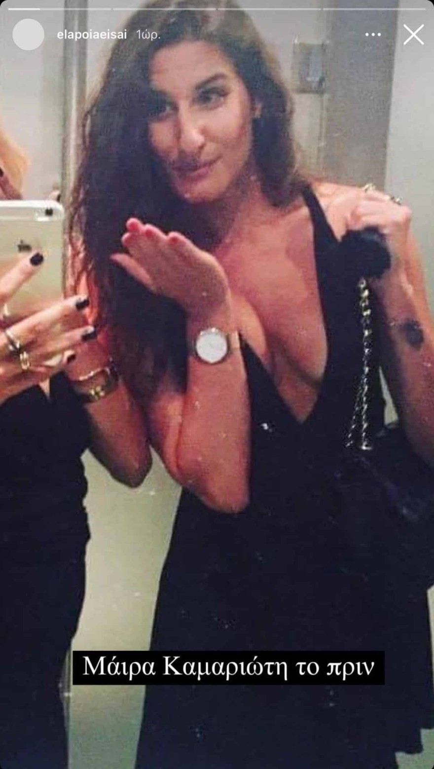 Μάιρα πριν από τις πλαστικές