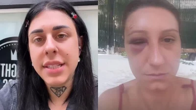 Συγκλονίζει η Super Κική: «Θα το ξανά έκανα...» - Έβγαλε στη φόρα φωτογραφίες της φίλης της με αίματα και σημάδια