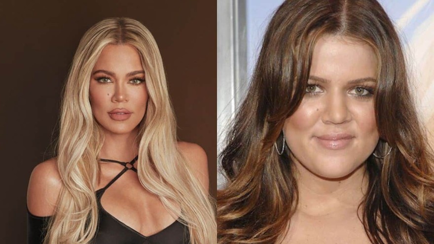 Η Κλόι Καρντάσιαν πριν και μετά τις πλαστικές