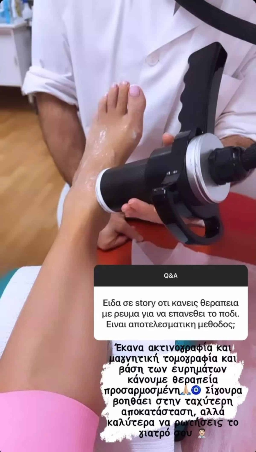 Σπυροπούλου πόδι