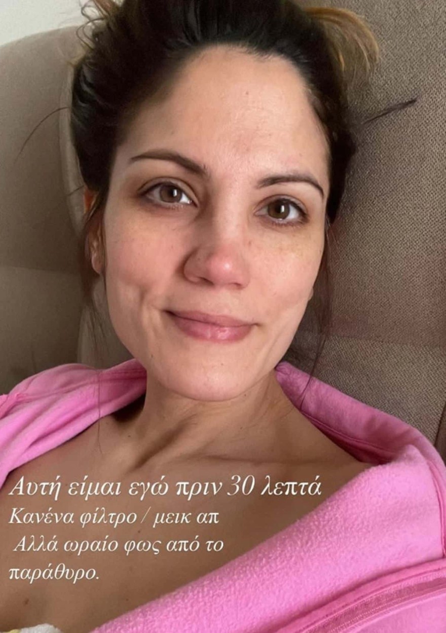 Συνατσάκη χωρίς φίλτρο