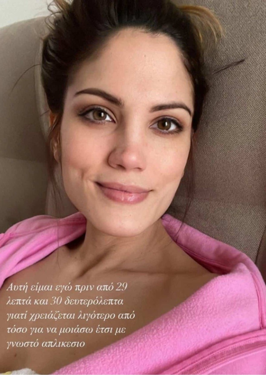 Συνατσάκη φιλτρο