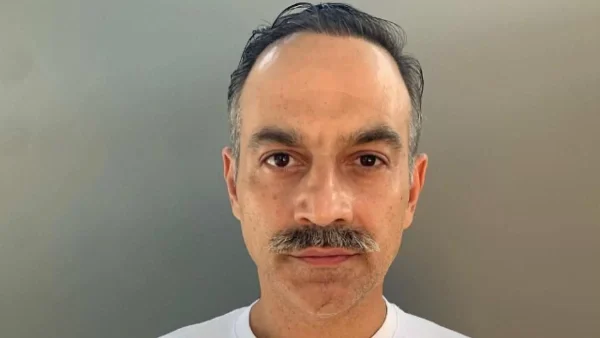 Ο Κρατερός Κατσούλης έκανε μεταμόσχευση μαλλιών - Οι φωτογραφίες από το πριν και το μετά